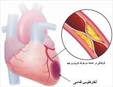 پاورپوینت بیماری اسکمیک قلبی
